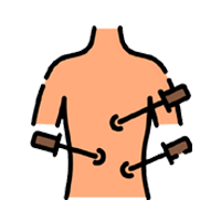 Laparoscopy